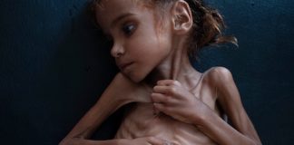 Amal-Hussaun-Died-From-Starvation-Thanks-to-Sauds